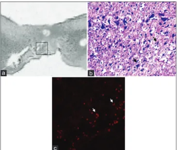 Figure 5: Light microscopy in FGG (a, b) vs. MSCG (c and d) at the injury  site 10 weeks after injury
