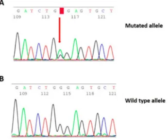 Figure 1. (A) Identification of the heterozygous c.2091G&gt;A mutation by Sanger sequencing