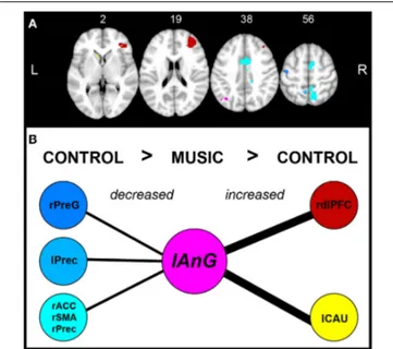 FIGURE 6 | Correlation of pain intensity and precentral-angular gyri connectivity. Scatter plot showing the linear positive correlation between the 1 PI and the 1 correlation of the connectivity between lAnG and rPreG