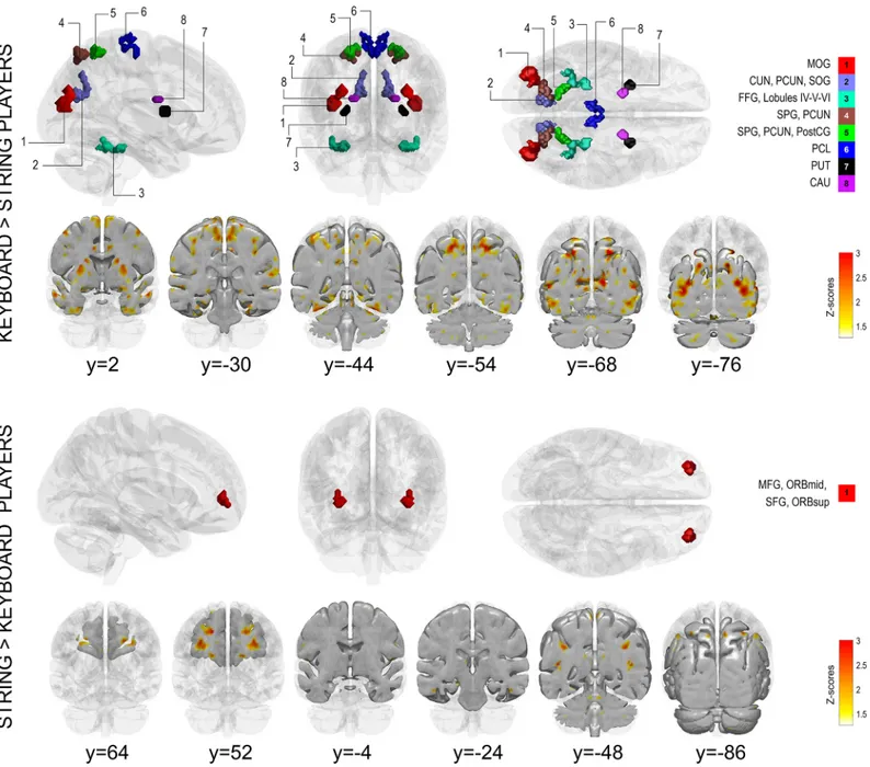 Fig 2. Symmetry maps showing significantly greater functional symmetry for keyboard players compared to string players (top figure) and for string players compared to keyboard players (bottom figure)