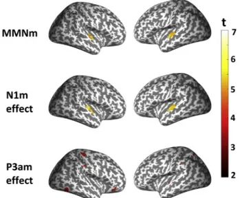 Fig. 9. Neural generators of the MMNm, N1m effect and P3am effect. Color maps depict t-statistics from one-sample t-tests