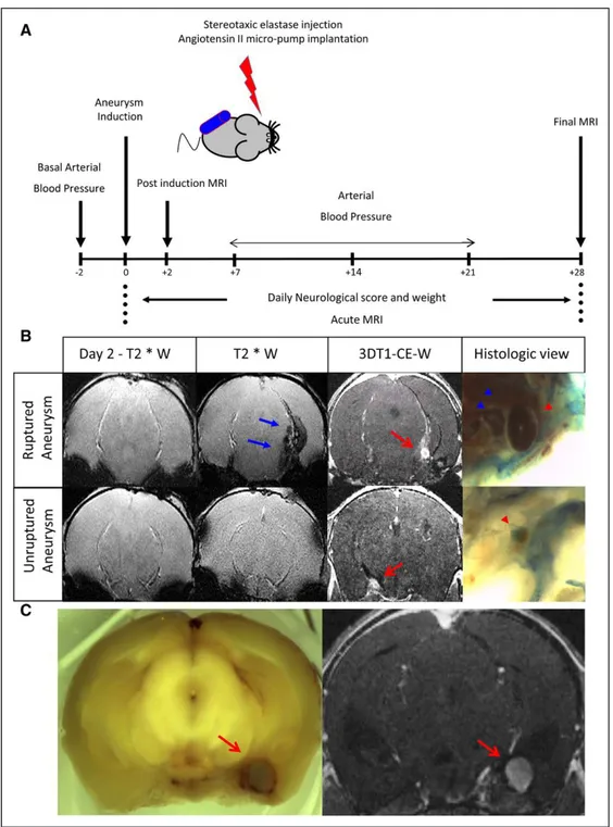 Figure 1. Experimental protocol. A, Six-weeks-old male mice maintained hypertensive by a chronic infusion of angiotensin II received 