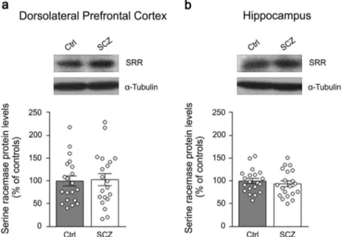 Fig. 5 Serine racemase protein levels in the post-mortem dorsolateral prefrontal cortex and hippocampus of patients with schizophrenia
