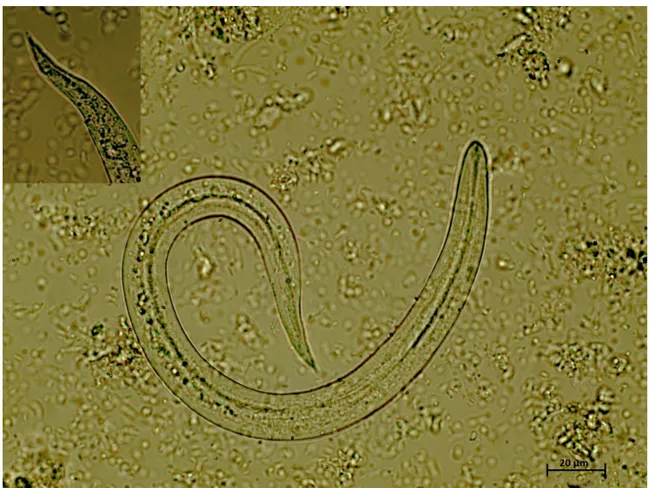 Fig. 2. Crenosoma vulpis fi rst stage larvae detected at the Baermann technique, 40x magnifi cation