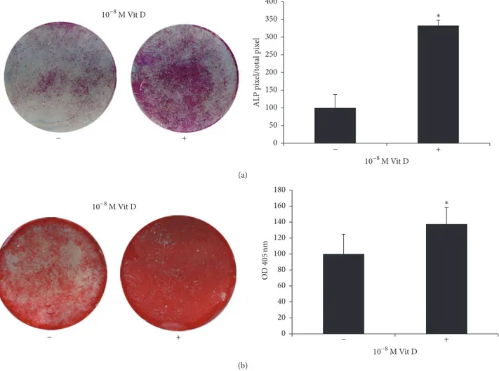 Figure 1: ALP positivity and mineralized nodules formation. (a) ALP histochemical assay (purple staining) performed on DBSCs seeded and differentiated for 7 days with vehicle (−) and 1,25(OH) 2 D 3 (+)