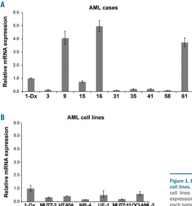 Figure 1. Expression levels of UNCX in acute myeloid leukemia (AML) patients and cell lines