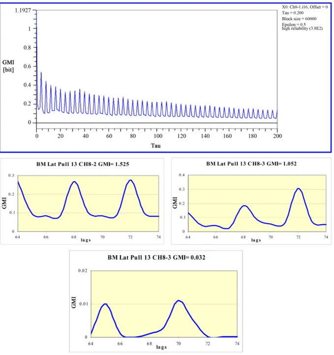 Figure 8. GMI results of the subject under first session of the treatment.                                                      