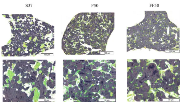 Figure 2. Light green and lugol’s iodine staining images of soy bread with 16% protein content (S37), 