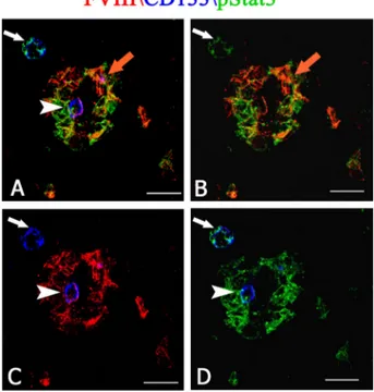 Figure 6: Multiple FVIII (red), CD133 (blue) and pStat3 (green) confocal immunofluoresce reaction