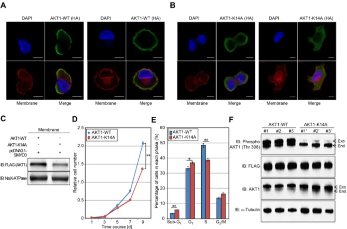 Figure 6: Methylation of AKT1 at lysine 14 promotes plasma membrane recruitment and proliferation of cancer cells