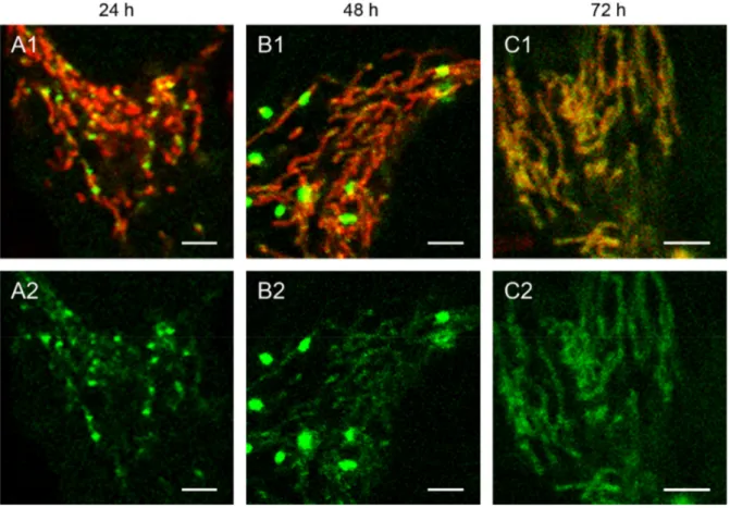Figure 2. Detailed images of HEp-2 cells transfected with circular depletion system.   Cells were transfected with the circular depletion system (pMEE-con with EGFP, green  color, bottom panels A2–C2) and analyzed by confocal laser scanning microscopy   at