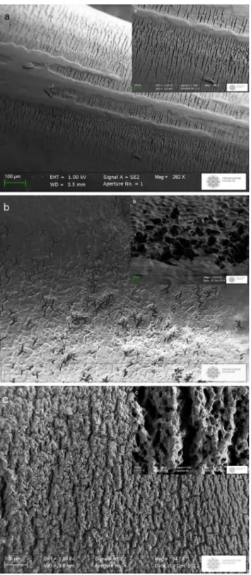 Fig. 2 Patient 3. Section of the outer jacket tubing: particular through SEM analysis at ×1010 magnification