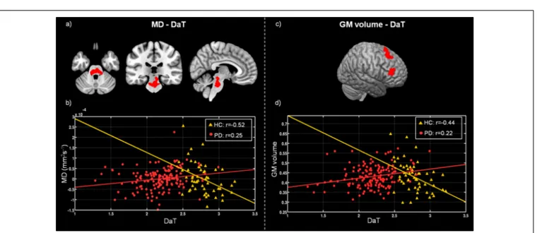 FIGURE 2 | Differences between healthy controls (HC) and Parkinson’s disease patients (PD) in voxel-wise correlation of MD maps with DAT-SPECT measured in putamen (a), and GM volume with mean DAT-SPECT in putamen (c)
