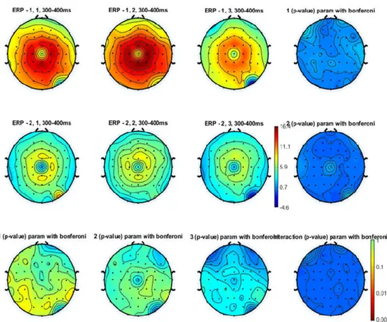 Figure 4. Topographical representation of the N2 component on the right hand stimulation