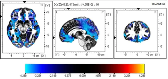 Figure 6. The sLORETA voxels expressing statistical analysis  results  in the control group between 