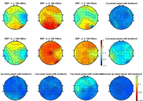 Figure 9. Topographical representation of the N1 component on the left hand stimulation