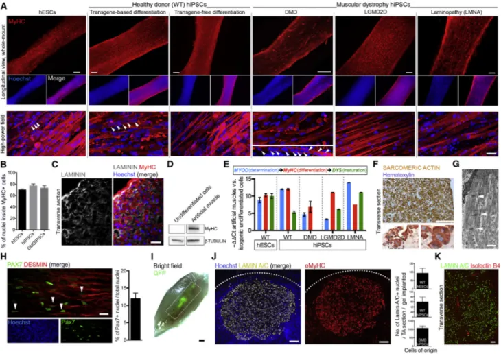 Figure 2. 3D Artificial Skeletal Muscle Constructs Derived from Healthy and Dystrophic hPSCs