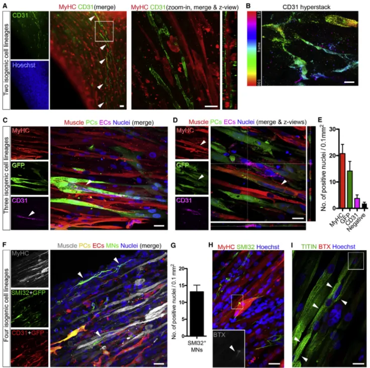Figure 4. Multilineage Artificial Muscles Containing Isogenic hiPSC-Derived Vascular Cells and Motor Neurons