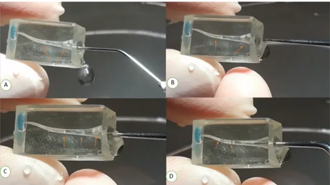 Figure 4. Vapor lock removal sequence using PUI in endo training blocks (s-shaped) whose apex was  closed using orthodontic wax