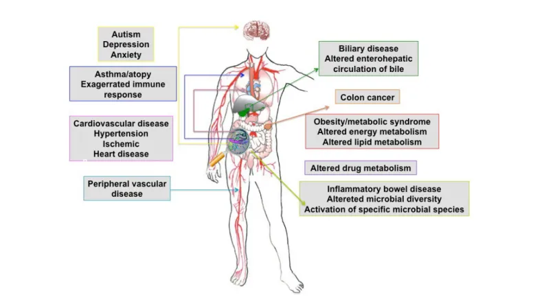 Figure 3: Systemic diseases directly influenced by gut microbiota. 