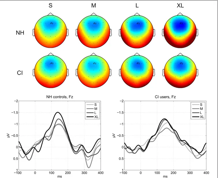 FIGURE 2 | MMN responses to deviant levels. (Top) Average MMN scalp topographies measured in a 30 ms time window centered on the global peak in the grand-average waveform at a latency of 147 ms