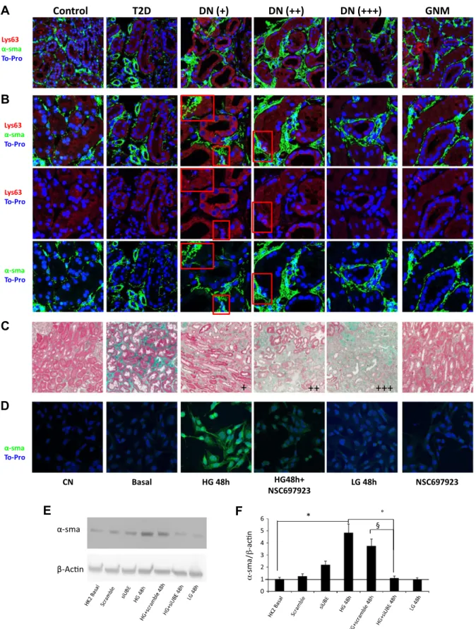 Figure 6. Lys63 ubiquitination and a-SMA expression in vivo and in vitro in tubular cells