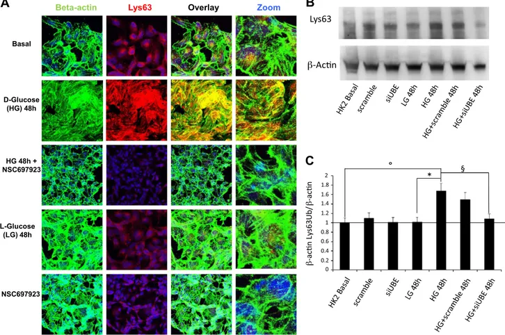 Figure 4. A) Immunoﬂuorescence analysis of b-actin distribution and Lys63 ubiquitination in HK2 cells