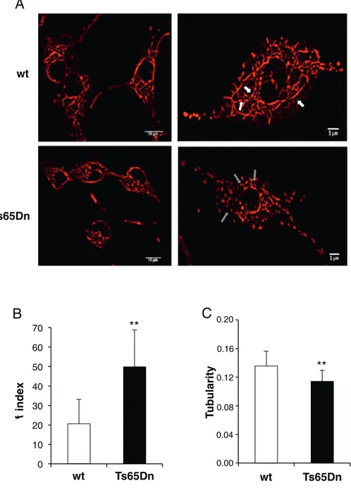 Fig. 1. Impairment of mitochondrial network in Ts65Dn- Ts65Dn-NPCs. (A) Representative images obtained by Confocal Microscopy of live cultured wt and Ts65Dn NPCs loaded with 0.5 μM MitoTracker®deepRed