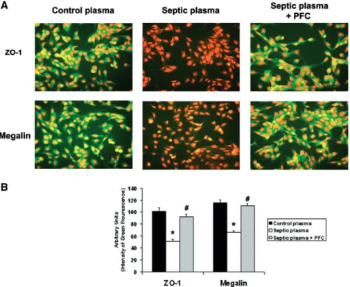 FIGURE 8: PFCs prevented septic plasma–induced down-regulation of the tight junction protein ZO-1 and the endocytic receptor megalin in TECd