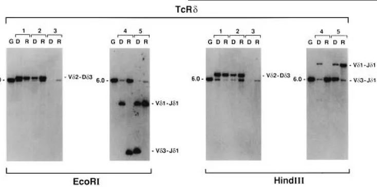 Figure 1 Southern blot analysis with the TcRDJ1 probe of EcoR1 and Hindlll cut DNA from bone marrow mononuclear cells of the five patients at diagnosis (D) and first relapse (R)