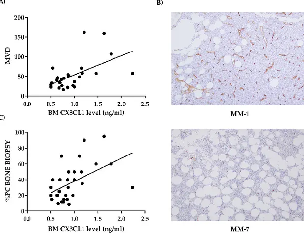 Figure  2.  BM  CX3CL1  correlates  with  MVD  in  MM  patients.  (A)  The  graph  shows  a  significant  positive correlation between CX3CL1 levels in BM plasma obtained from 27 MM patients and MVD,  evaluated  as  CD34 +   cells/mm 2  by  immunohistochem
