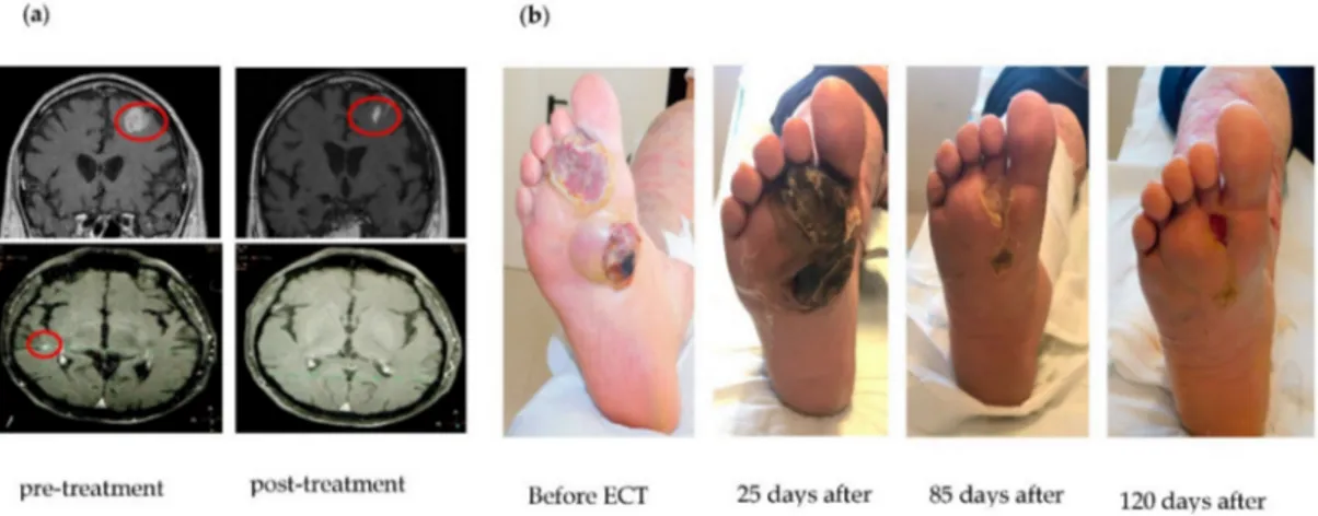 Figure 2. Representative cases of patients treated with different loco-regional treatments on