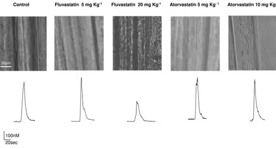 Fig. 2. Effect of the in vivo chronic treatment with fluvastatin and  ator-vastatin on the gross morphologic  fi-bers aspect and on the  excitation-cal-cium release coupling