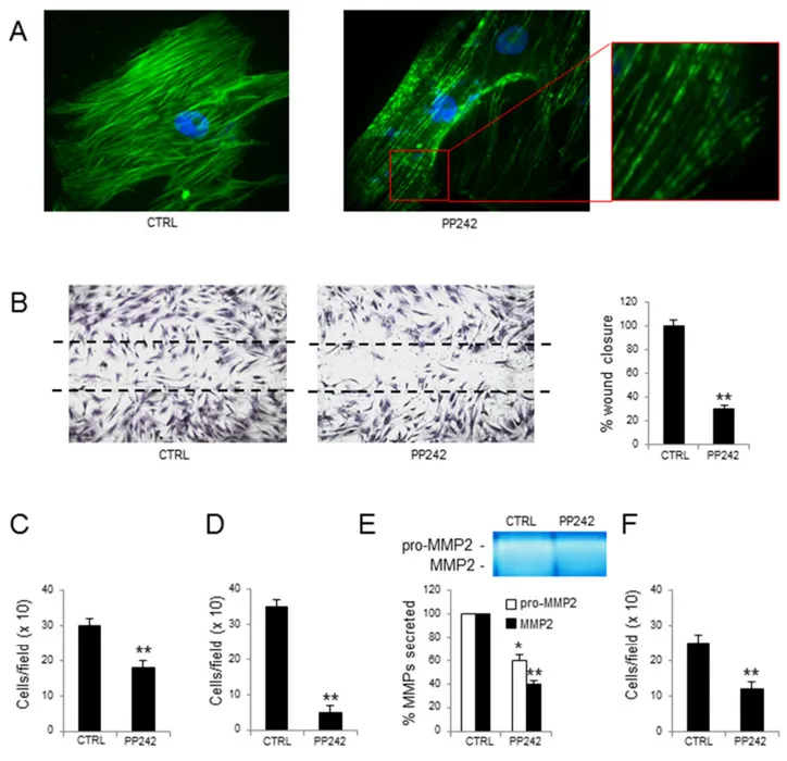Figure 4: Effects of PP242 treatment on MM-ECs. MM-ECs (n=10), treated or not with PP242 (100 nM for 48h), were tested  for (A) immunofluorescence to stain actin fibers with Phalloidin (green), nuclei were counterstained with 4’,6-diamidino-2-phenylindole 