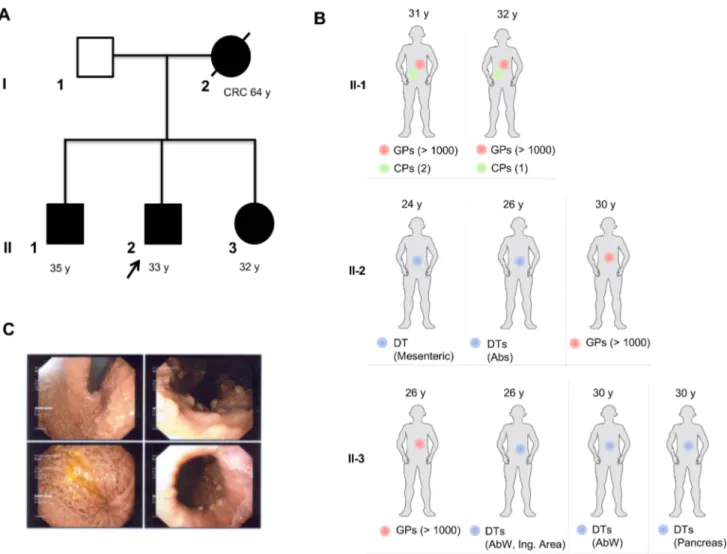 Figure 1  Family pedigree and relevant clinical findings in individual patients. (A) Squares indicate men, circles represent women