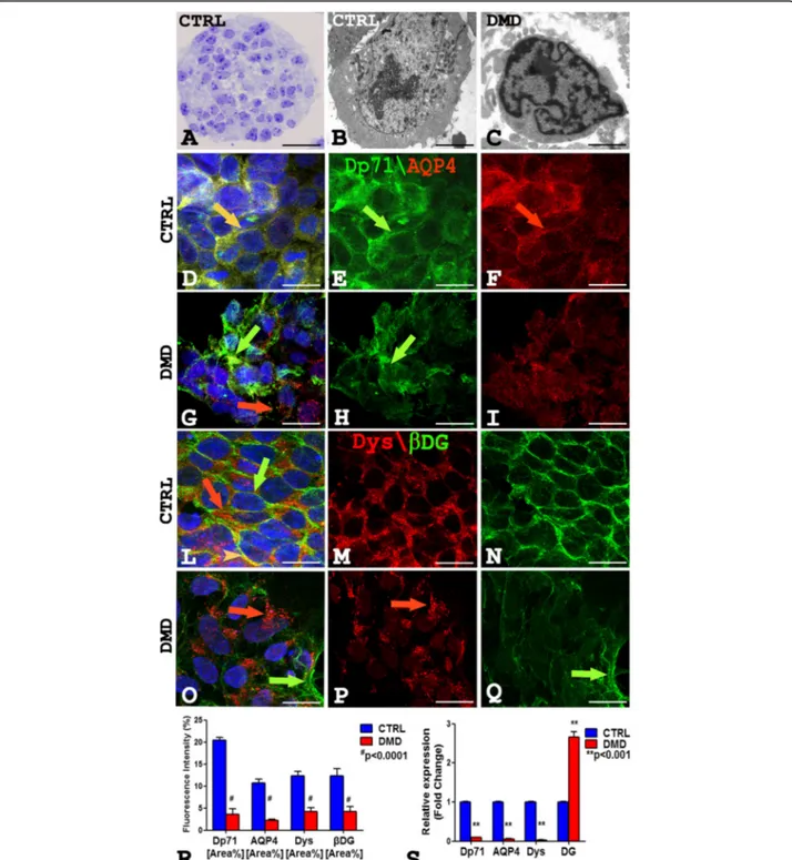 Fig. 1 a –c Semithin CTRL section stained with toluidine blue (a) showing a rounded neurosphere with healthy cells, and ultrathin section (b, c) of hiPSCs showing a larger CTRL hiPSCs with abundant mitochondria and organelles (b) compared to DMD hiPSCs wit