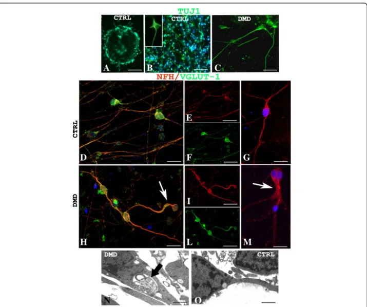 Fig. 2 Confocal immunofluorescence reaction of TuJ-1 in CTRL (a, b) and DMD (c) neurons reveals prevalently multipolar control neurons (b inset) and unipolar and bipolar DMD neurons (c)