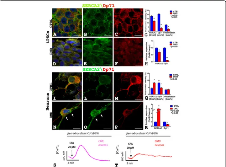 Fig. 4 SERCA2 (green) and Dp71 (red) fluorescence signals decrease and diffuse in DMD hiPSCs cytoplasms (d –f) compared to intense