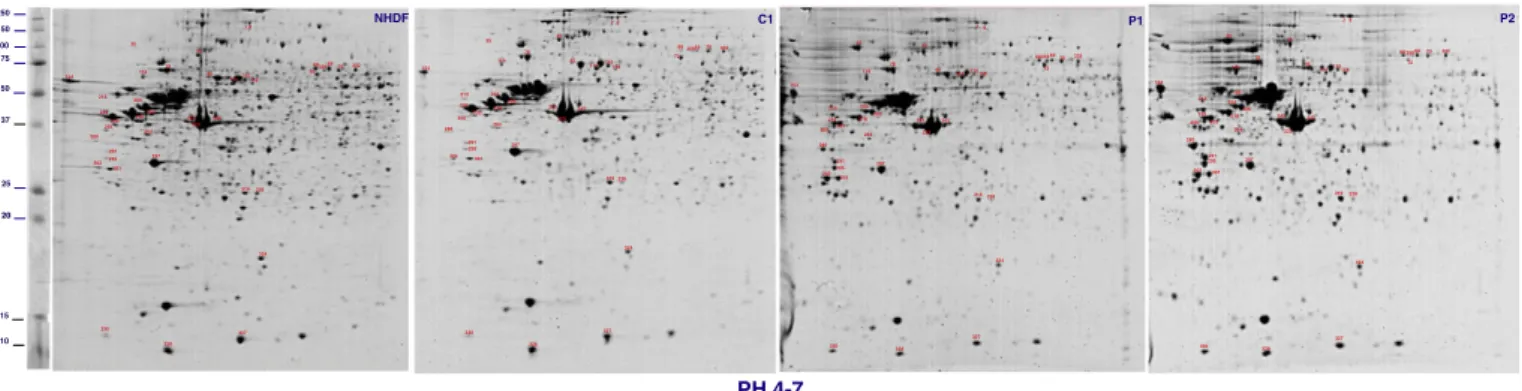 Fig. 1. Representative 2-DE maps (linear IPG 4–7 pH) of the total protein extracts from normal adult human dermal ﬁbroblasts (NHDF), healthy subject ﬁbroblasts (C1) and ﬁbroblasts from the two unrelated PD patients (P1, P2)