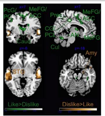 FIGURE 4 | Main effect of Liking. ACC, anterior cingulate cortex; Caud, caudate; CG, cingulate gyrus; PCL, paracentral lobule; PC, posterior cingulate; Cul, cerebellar culmen; STG, superior temporal gyrus; Amy, amygdala; AN, thalamic anterior nucleus; Prec