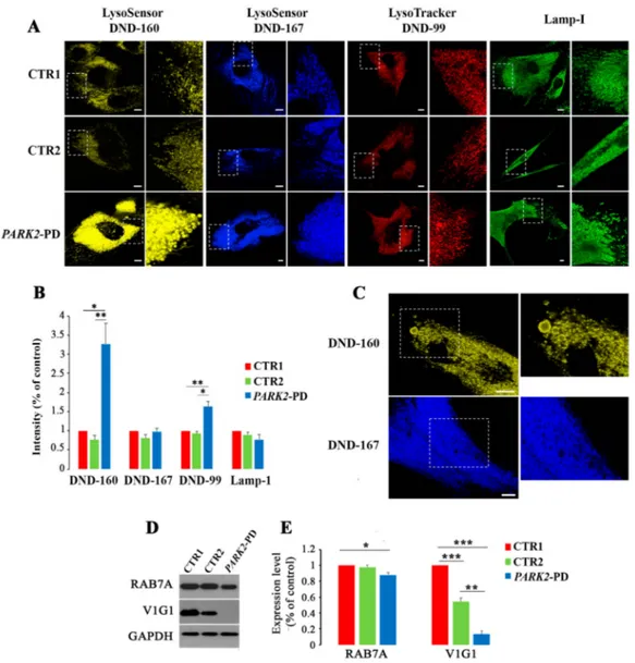 Figure 1. Alterations of late endocytic compartments in PARK2-PD cells. (A) Cells were labeled live with LysoSensor DND-160 (yellow), with LysoSensor DND-167 (blue) and with Lysotracker Red DND-99 or were fixed and immunostained with anti-LAMP1 antibody (g