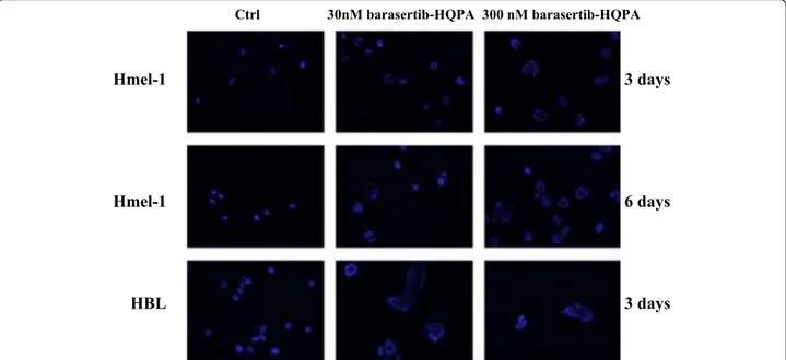 Figure 3 Modification of nuclear morphology following exposure to barasertib-HQPA. BRAF-mutated melanoma cells were exposed to 30 and 300 nM barasertib-HQPA and after three and six days, polynucleate cells were evidenced by ICC (blue: DAPI).