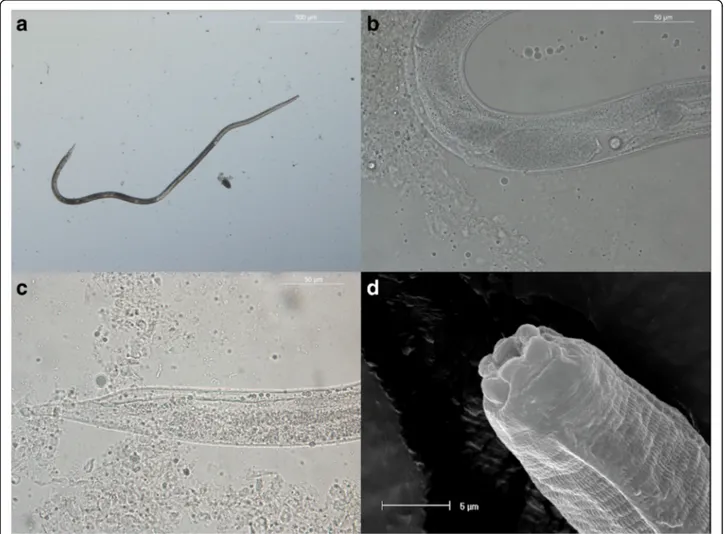 Fig. 2 Adult Strongyloides stercoralis female collected from a duodenal scraping. a Parasitic female in toto: oesophagus length is appreciable