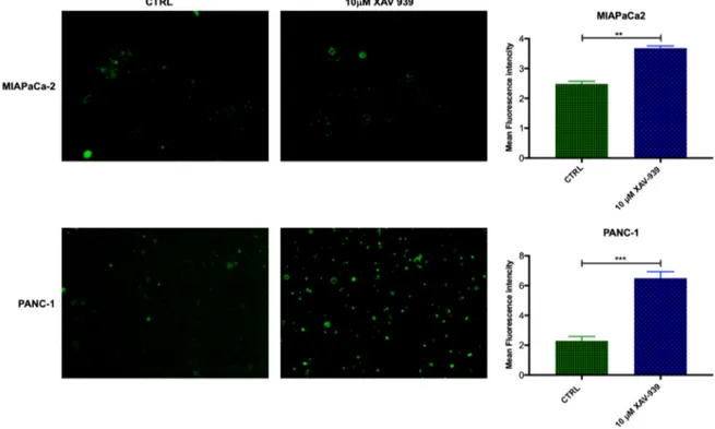 Figure 9. Immunofluorescent detection of CD40 in mDCs kept in contact with PDAC cells (MiaPaCa- (MiaPaCa-2 in the upper panel and PANC-1 in the lower one) and XAV-939 (10 µM)
