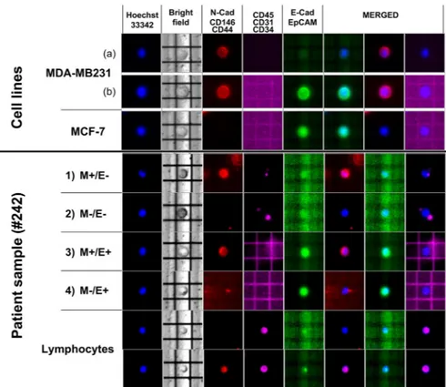 Figure 1.  Representative images of CTCs isolated by DEPArray. The upper panel shows spiking experiments  performed by using MDA-MB231 and MCF-7 BC cell lines predominantly expressing mesenchymal (M:  N-cadherin/CD146/CD44; PE, red) and epithelial markers 