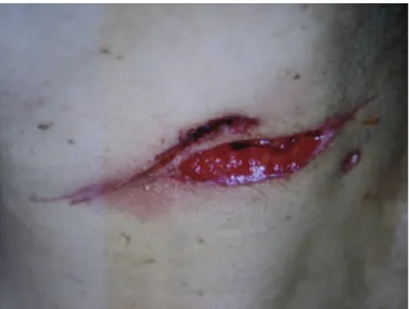 Fig. 2. Close-up of the stab wounds on the left side of the neck.