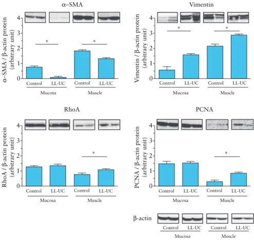 Figure 6.  Fibrotic markers in the inflamed colon of long-lasting [LL] ulcerative colitis [UC]