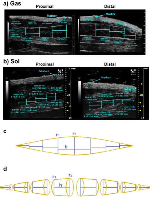 Figure 2.  Representative ultrasonographic images of truncated cone calculation method of gastrocnemius  and soleus muscle volumes