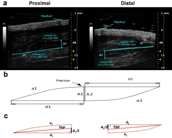 Figure 3.  Representative ultrasonographic images of the novel sinusoidal calculation method of soleus  muscle volume