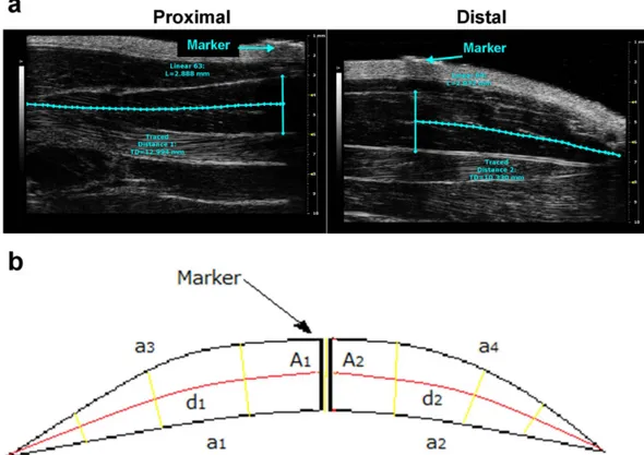 Figure 5.  Representative ultrasonographic images of the novel sinusoidal calculation method of  gastrocnemius muscle volume